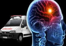 Rescate cerebral: un tipo de ambulancia que acelera el diagnóstico de ACV