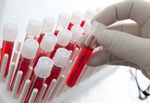 Liquid Biopsies to Monitor Cancer Move Forward