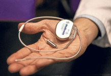Ultrasmall pacemakers implanted