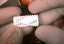 Impresiones 3D de cartílagos