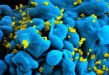 Logran frenar la capacidad infecciosa del virus del sida.
