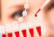 Un simple análisis de sangre detecta 8 tipos de cáncer