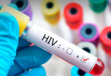 Anuncian el segundo caso en la historia de un paciente al que le «eliminan» el VIH