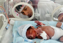 Por día, nacen en la Argentina 20 bebés prematuros con un peso inferior a los 1.500 gramos