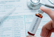 Se detectaron dos casos de tuberculosis en adolescentes en una escuela porteña