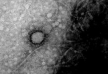 El ANLIS – Malbrán captó la primera foto del nuevo coronavirus que circula en Argentina.
