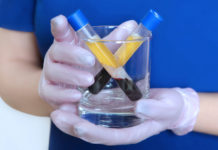 Mejoraron el 90% de los pacientes con Covid-19 tratados con plasma en Buenos Aires.