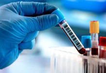 El test serológico argentino para COVID-19 llegó a los 100.000 ensayos