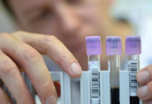 Coronavirus: un análisis de sangre podría indicar qué personas pueden desarrollar un cuadro grave de COVID-19