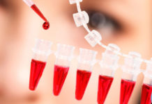 Cómo es el innovador kit argentino que promete detectar el cáncer de mama y el de próstata antes que los análisis tradicionales.