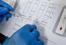 Más de 120 millones de test rápidos de Covid-19 serán distribuidos a países de ingresos bajos y medianos