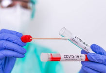 Covid anticuerpos: un nuevo estudio apunta a 3 meses de inmunidad