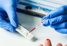 Un nuevo estudio revela que la inmunidad al coronavirus podría durar años.