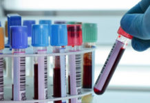 Coronavirus: un test de sangre podría anticipar qué pacientes tendrán una evolución grave de la enfermedad