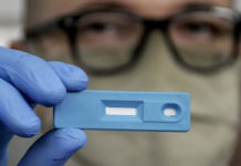 La Anmat aprobó el test argentino para la detección rápida de coronavirus