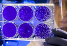 Cuáles son las 5 mutaciones más preocupantes del COVID-19 y qué peligro representan realmente.