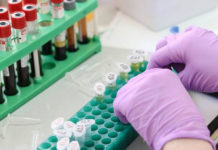 Identifican una nueva diana farmacológica para tratar el aneurisma de aorta abdominal