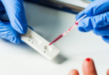 La OMS anunció la primera licencia «transparente, global y no exclusiva» para la Covid-19