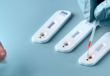 ¿Pude haber tenido COVID-19 y no me di cuenta?