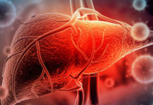 Hepatitis aguda en niños: 10 preguntas y respuestas sobre la enfermedad cuya causa es desconocida