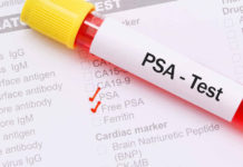 Se estima que uno de cada 8 hombres tendrá cáncer de próstata a lo largo de su vida