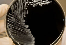 Legionella: hace casi una década la UNNE viene estudiándola y alerta sobre la importancia de estudios epidemiológicos