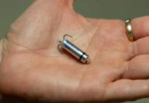 Sin cables y de titanio puro: ya se usa en la Argentina el marcapasos más chico del mundo
