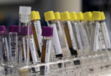 Un análisis de sangre podría detectar cáncer antes de que aparezcan síntomas