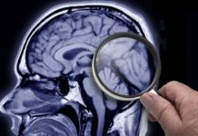 Cómo es la SLYM, la estructura del cerebro recién descubierta