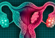 ¿Se puede erradicar cáncer de cuello uterino?